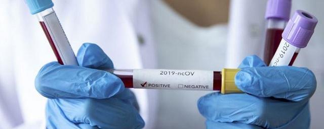 29 приморцев за последние сутки заразились коронавирусом