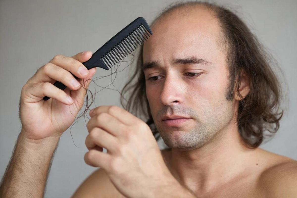 Врач: выпадение волос может быть связано с серьезными заболеваниями, но не является главным симптомом