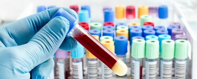 В Красноярском крае за сутки COVID-19 выявили у 132 человек