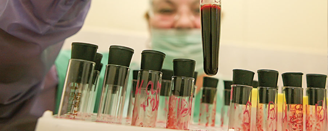 В Кирове 21-летнюю девушку обвиняют в заражении ВИЧ