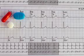 Cardiologist explained why heart rate increases and whether it is dangerous