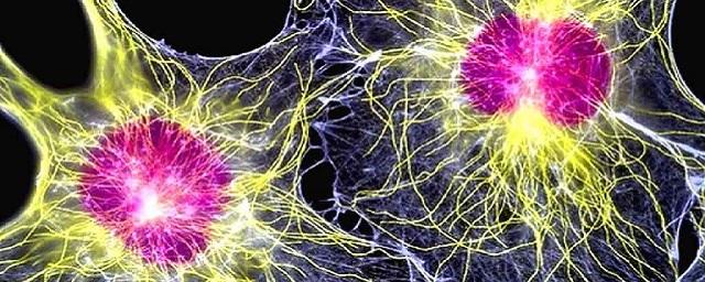 Ученые создали самонаводящиеся клетки для лечения опухолей мозга