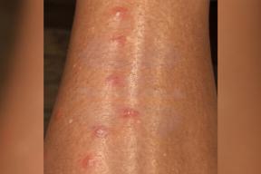 Российских туристов на Сейшелах атакуют песчаные мухи