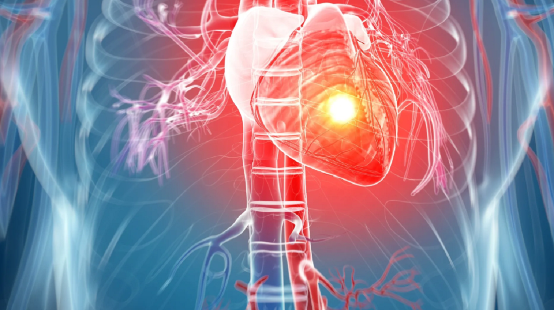 Врач-кардиолог Нилова назвала типичные и неочевидные симптомы сердечной недостаточности