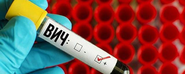 В Ростове зафиксировано увеличение числа выявленных случаев ВИЧ