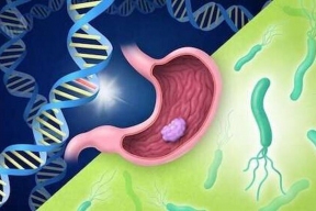 Рак желудка угрожает 15 миллионам молодых людей