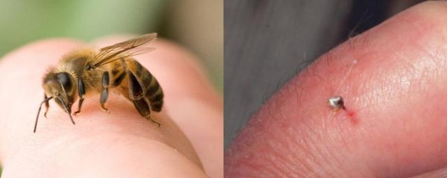 Врач Новиков: скорую стоит вызвать, если пчела укусила человека с аллергией в лицо
