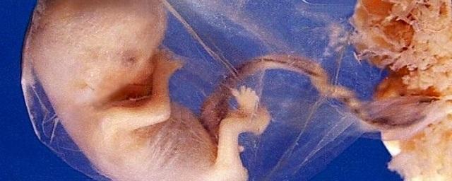 Ученые: Из эмбриона с отклонениями может родиться здоровый ребенок
