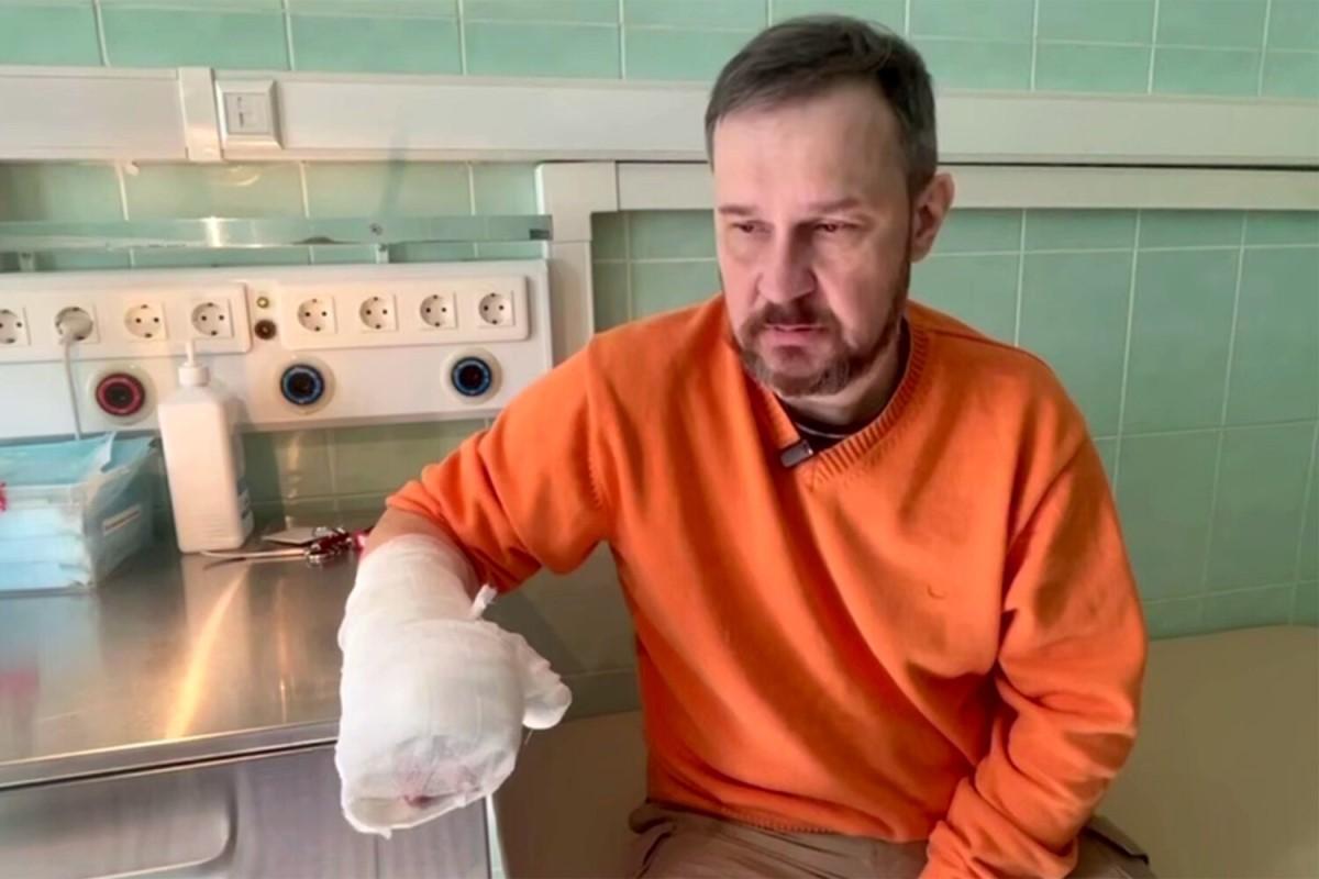 Хирурги пришили пальцы мужчине, который отрезал их пилой