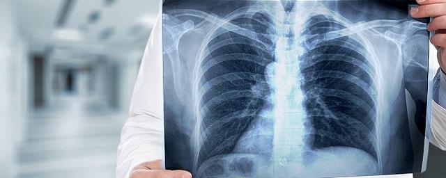 Russian tuberculosis test included in WHO recommendations