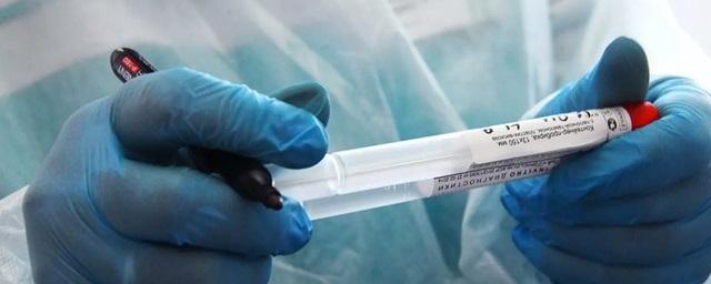 Еще 42 человека заболели коронавирусом за сутки в Карелии