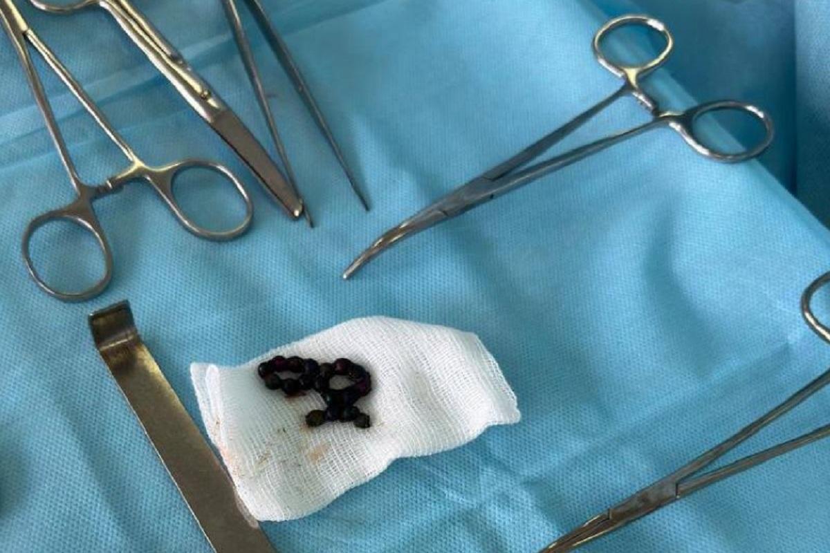 На Ставрополе хирурги ужаснулись находке в кишечнике трёхлетнего ребенка