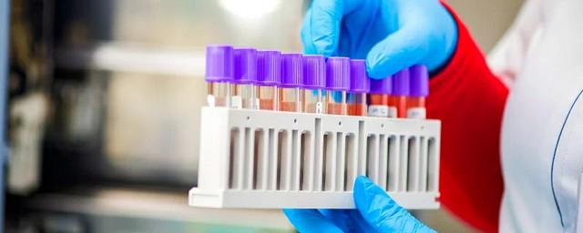 Ростовская лаборатория в сутки делает 300 тестов на коронавирус