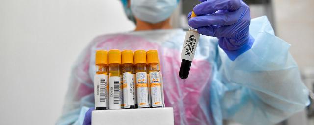 В Тамбовской области обнаружены еще 94 заразившихся коронавирусом