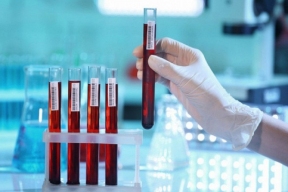 Онколог Иванов рекомендовал сдать общий анализ крови для выявления онкологии