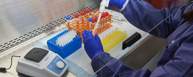 Эксперт рассказал, кому бесполезно делать тест на антитела к коронавирусу