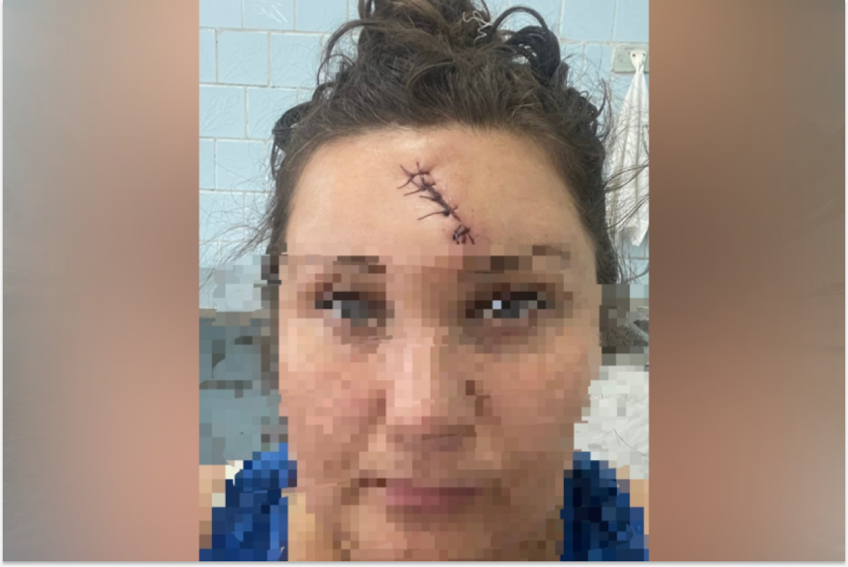 В Тверской области мужчину судят за нападение с трубой на незнакомку