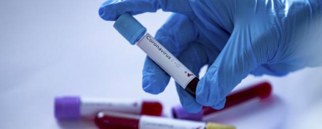В Тамбовской области обнаружены еще 33 заразившихся коронавирусом
