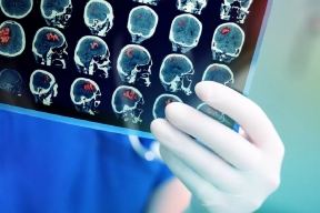 Врач Мясников рассказал, как защититься от инсульта