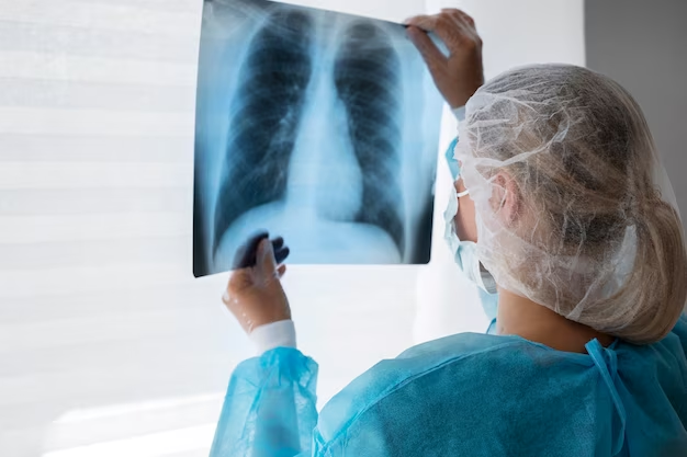 Стало известно о росте заболеваемости туберкулезом в России