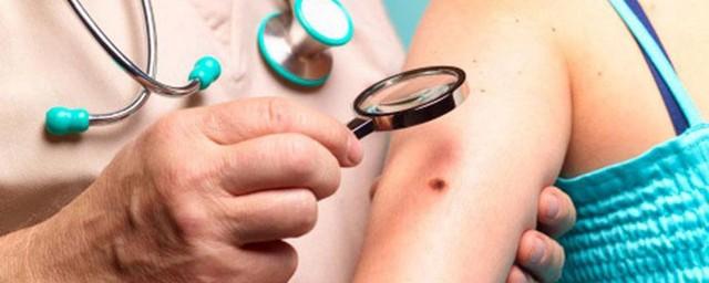 Калининградцев бесплатно проверят на рак кожи