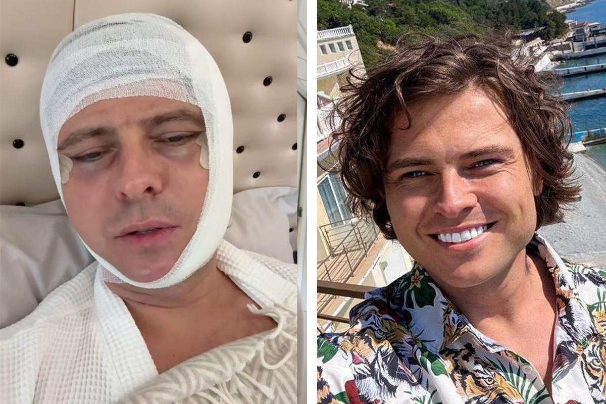 Страшно, всё лицо в синяках. Стало известно, кто отправил Прохора Шаляпина на больничную койку