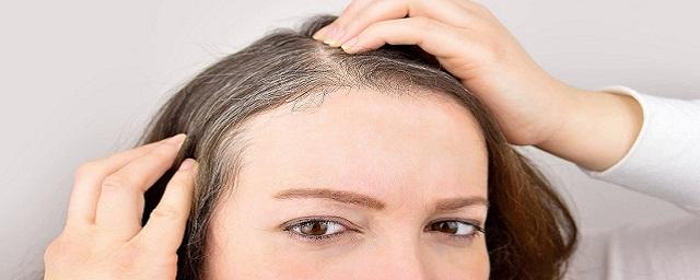 Дерматовенеролог Турбовская объяснила, почему в молодом возрасте появляются седые волосы