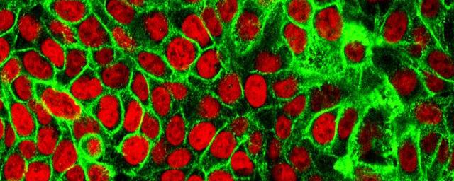Чип для биопсии жидкостей может обнаружить раковые клетки до образования опухоли