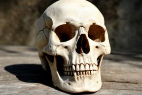 Археологи нашли череп с древнейшей трепанацией, сделанной высокорослому юноше в IX веке