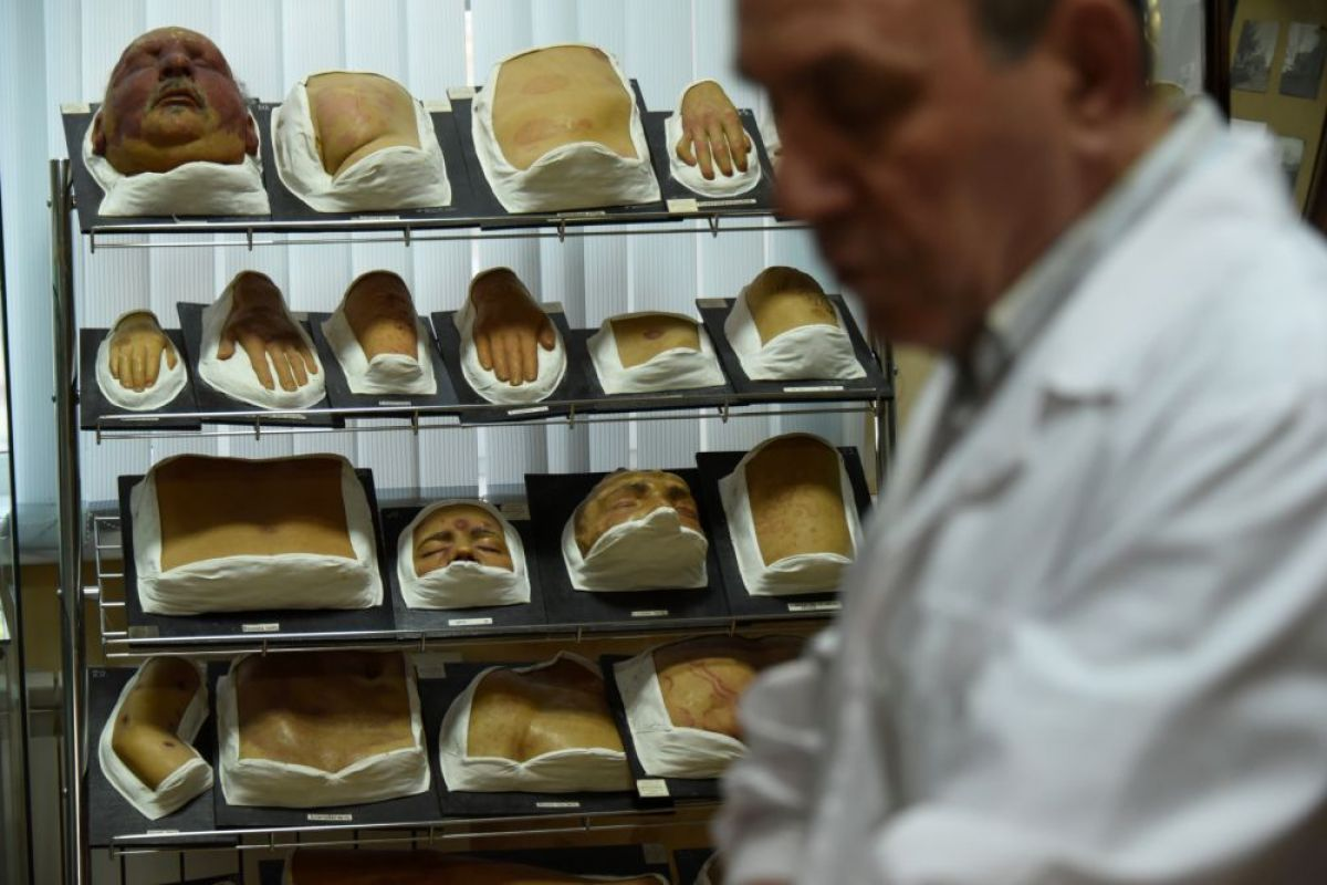 Ученые выяснили, что проказа существовала в Америке 10 000 лет назад