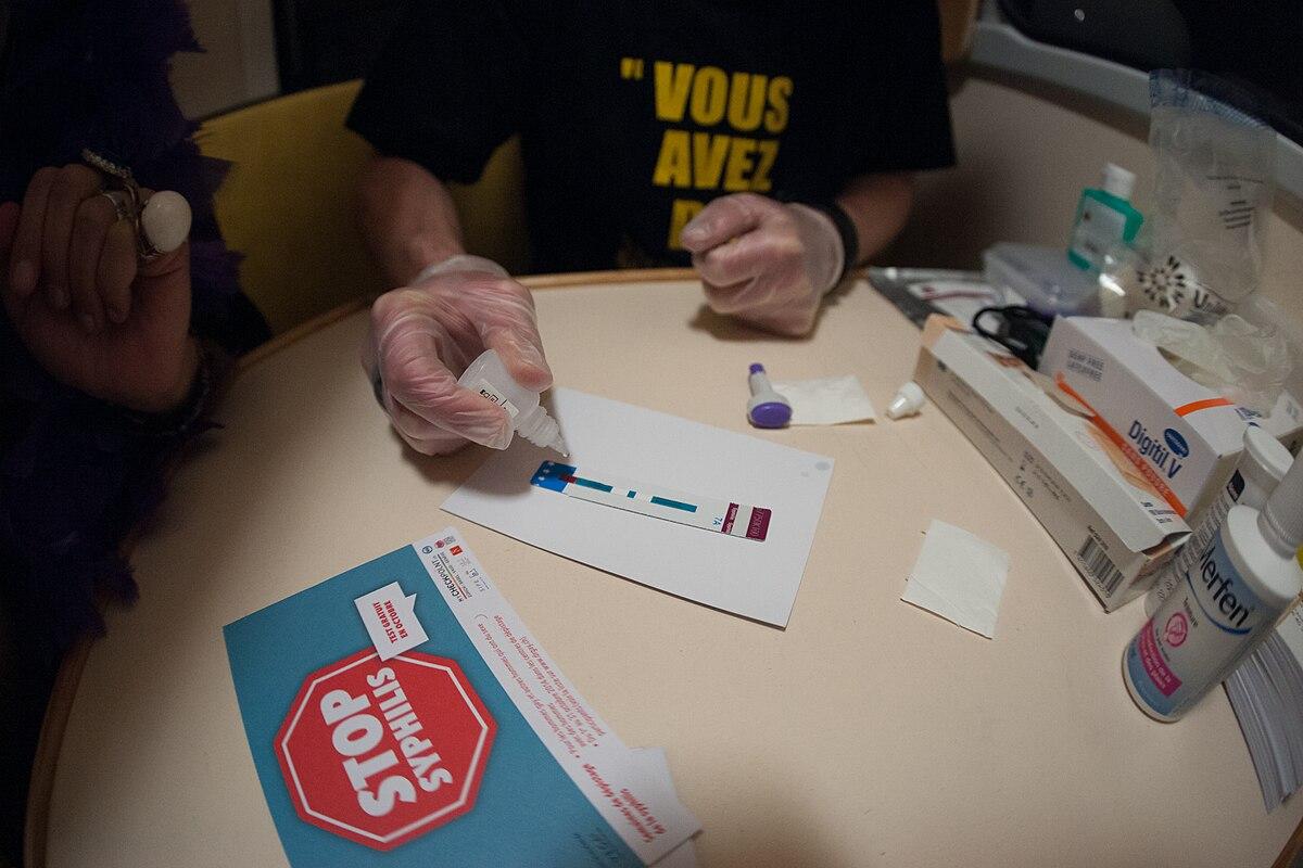 Жители Новосибирска перестали болеть врожденным сифилисом