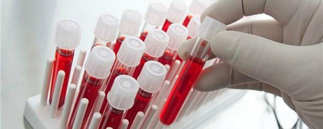 В Пскове можно бесплатно сдать тест на ВИЧ-инфекцию