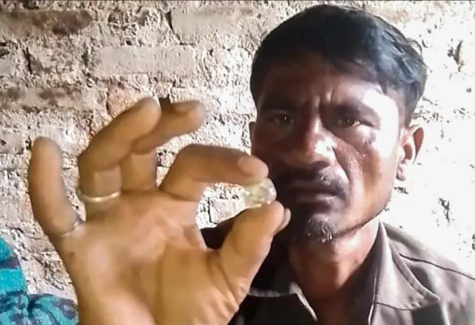 Нищий индийский шахтер нашел драгоценный камень