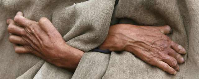 Специалист рассказал о забытой, но все еще реальной проказе