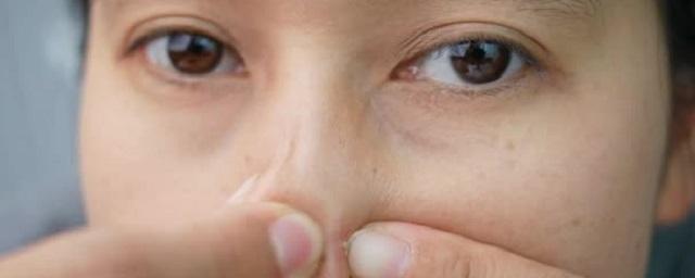 Лор Зайцев рассказал, чем может закончиться выдавливание прыща на носу в домашних условиях