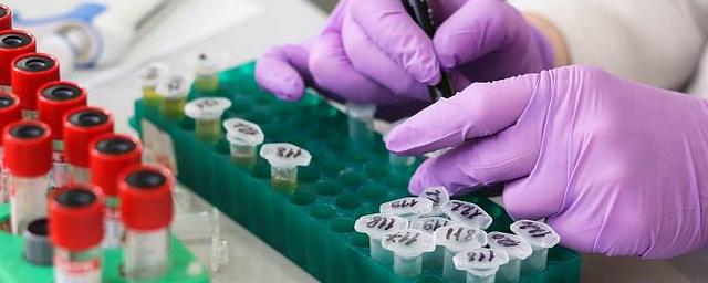 95 новых случаев заражения коронавирусом выявлено в Забайкалье