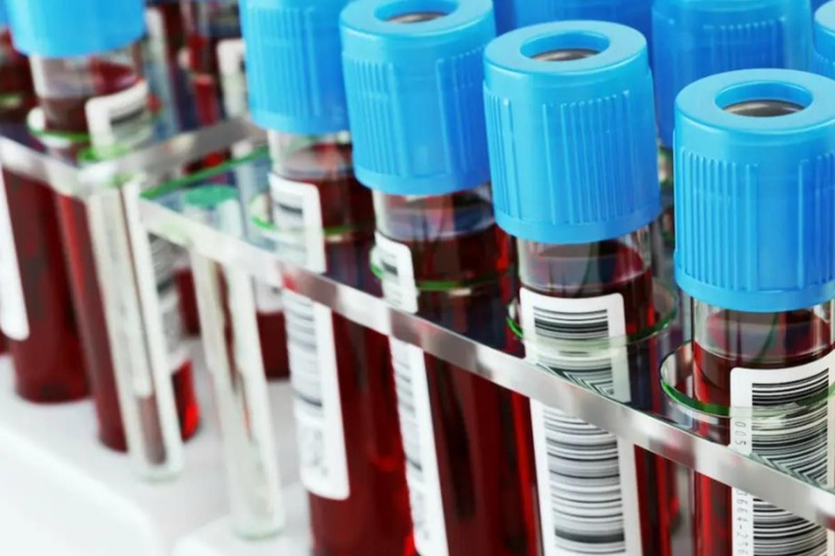 В Таиланде обнаружили сверхредкую мутацию группы крови