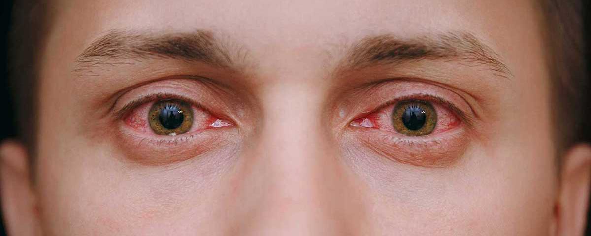 Эксперт Исаев заявил, что «омикрон» может проникать в организм через глаза
