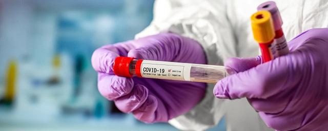 В России создали тест на выявление иммунитета к COVID-19
