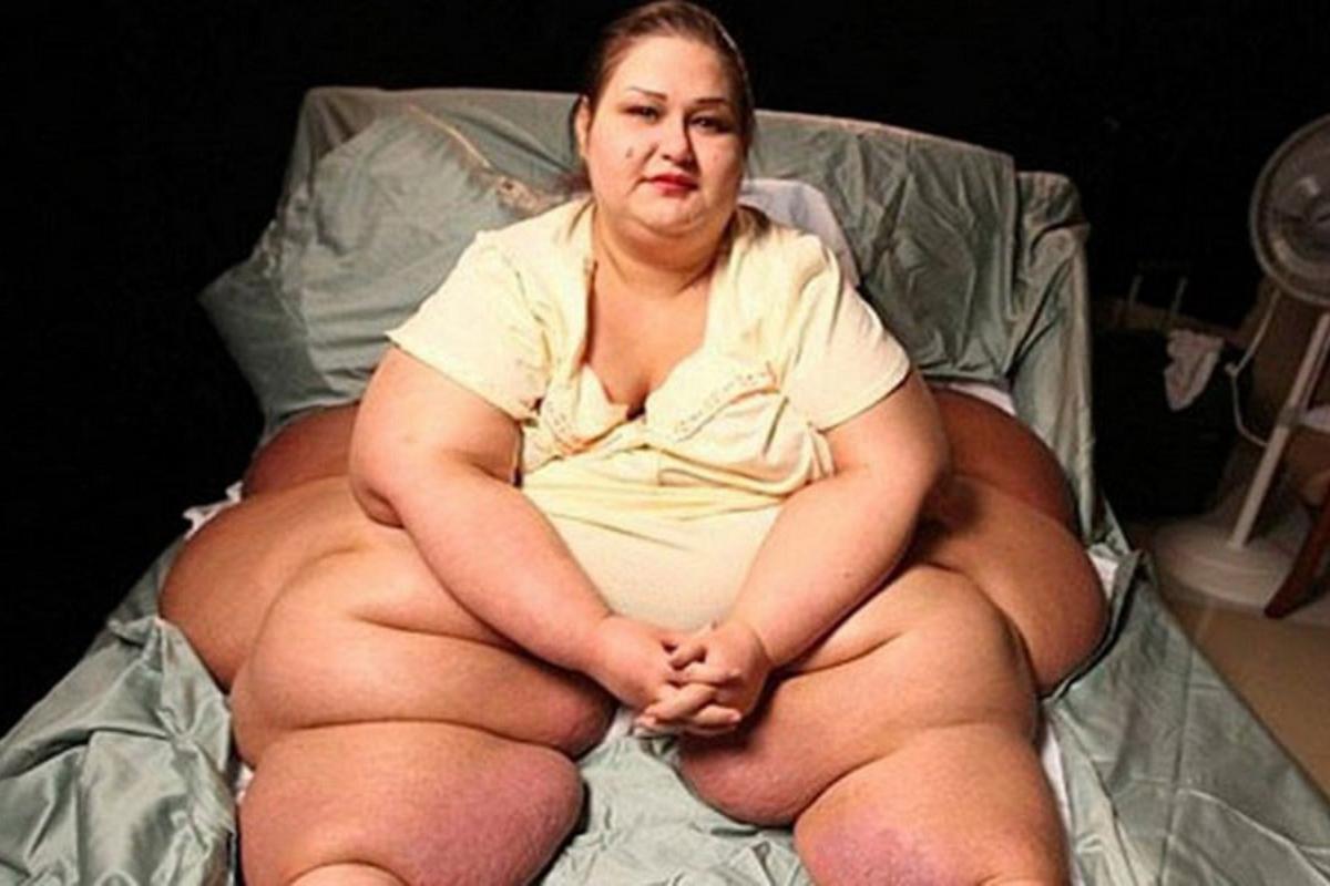 «Жизнь стоит того, чтобы бороться». Как самая толстая в мире женщина превратилась в «дюймовочку»
