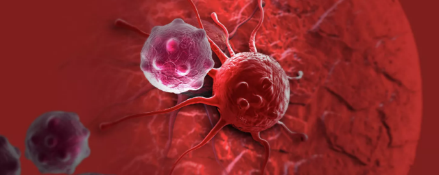 Онколог Недозимованый рассказал, как самому вычислить рак кишечника до симптомов