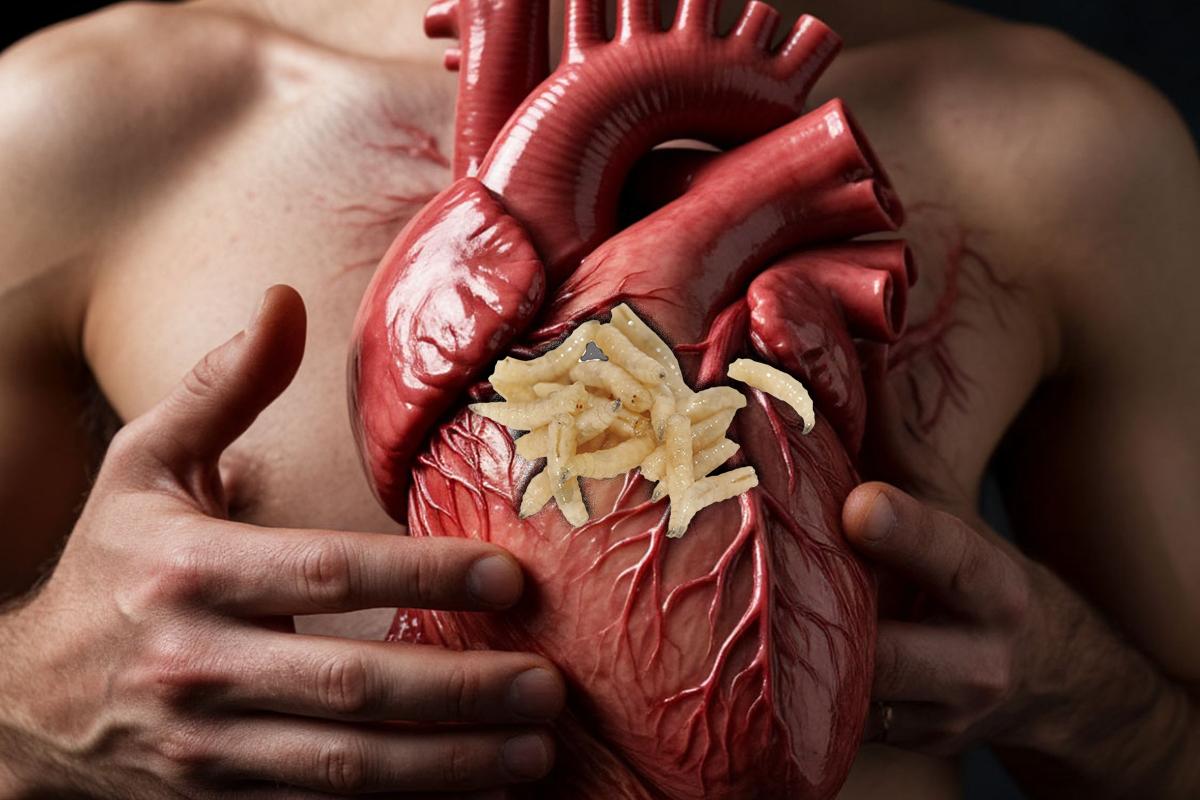 Черви едва не съели сердце. Чтобы спасти россиянина, врачам пришлось его «убить»