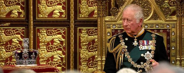 Отёкшие пальцы на руках нового британского монарха Карла III вызывают опасения врачей