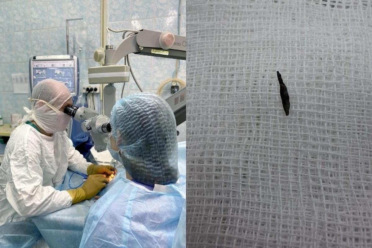 В Ижевске офтальмологи провели операцию пациенту с сантиметровым осколком в глазу