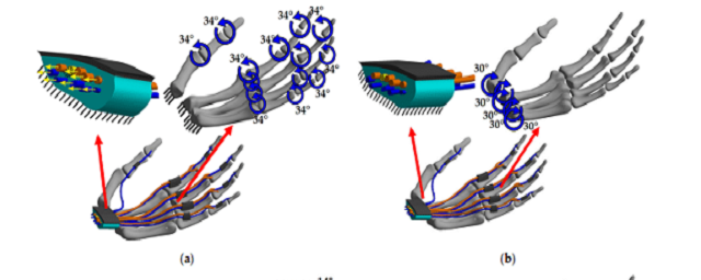 В Пермском политехе создали программу для диагностики синдрома запястного канала