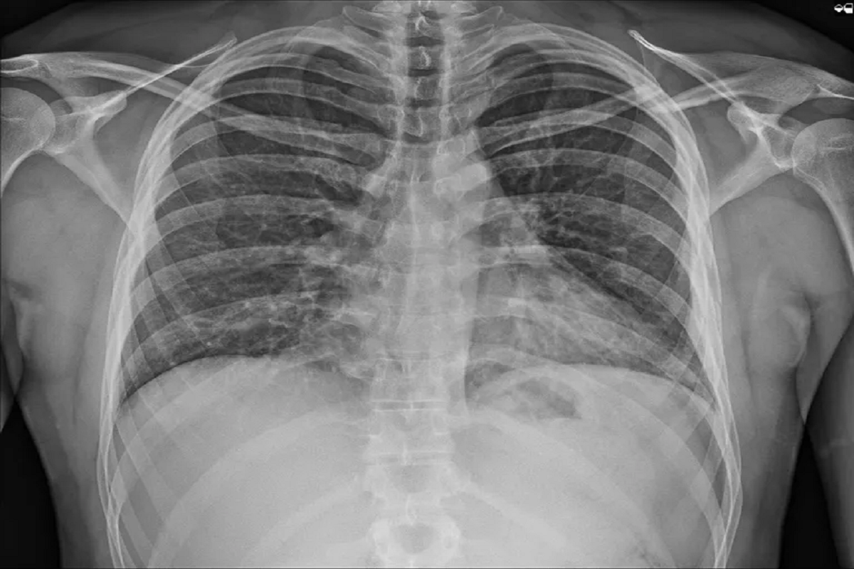 Хирург Кудзаев предложил новый метод уменьшения талии