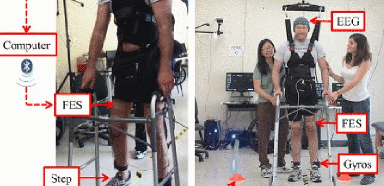 Ученые смогли вернуть парализованному мужчине способность ходить