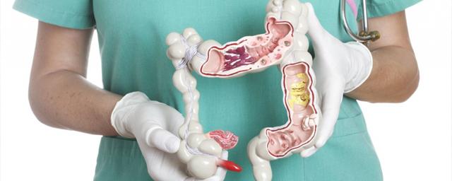Онколог Беджанян: Анализ кала на скрытую кровь поможет выявить рак кишечника