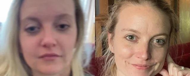 Woman gave up alcohol for three years and showed her face
