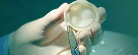 An innovative prosthetic heart valve has been developed in Russia